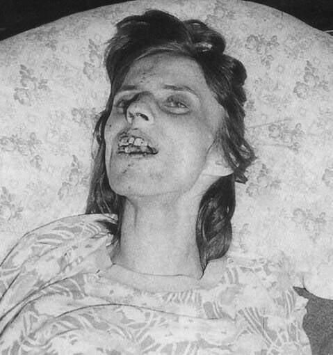 The Exorcism Of Anneliese Michel Creepiest Images