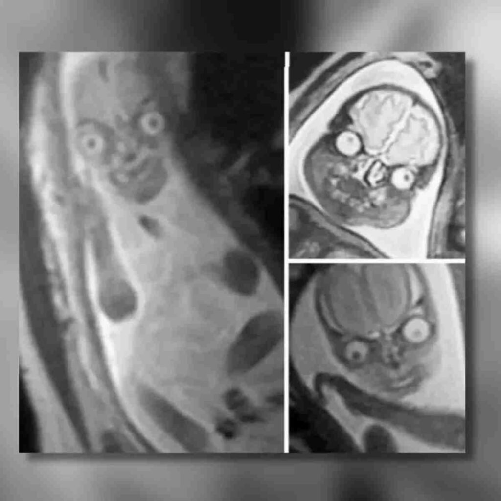 A Baby's MRI Creepy Photos