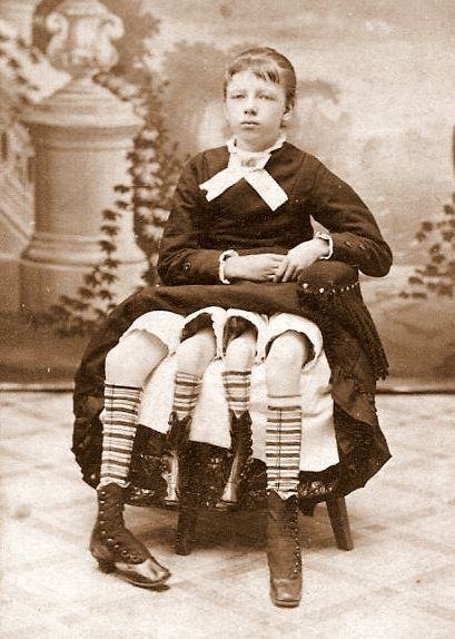 Myrtle Corbin, the Four-Legged Woman (1868) Creepy Photos